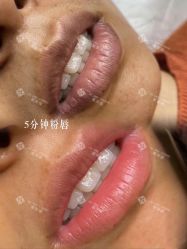 点击看大图 -杨益美学·野生眉半永久纹眉发际线