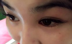 picture-元熙兰积皮肤管理
