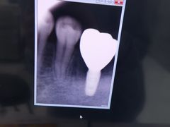 -同步齿科·数字化正畸种植口腔中心(珠海店)