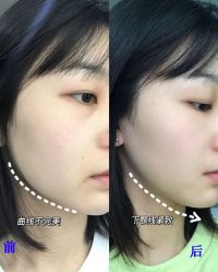 -郑州米兰柏羽集美医疗美容医院