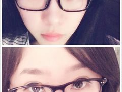 上面是第七天的，下面是第九天化妆后的。-上海华安整形外科门诊部