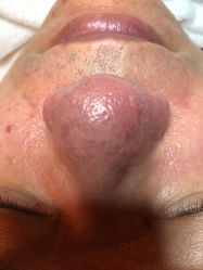 -SKIN MOLY魔力之肌皮肤管理中心