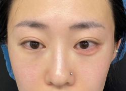 点击看大图 -Yestar艺星医疗美容医院