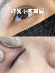-德绣·机器野生眉发际线·美瞳线半永久