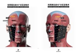 -丰联丽格医疗美容·联合丽格眼整形中心