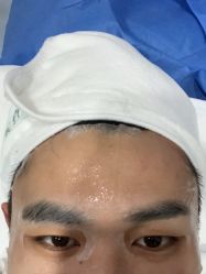 体验后-上海漾颜医疗美容