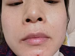 -杭州市第三人民医院