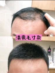 -唐风采假发补发定制
