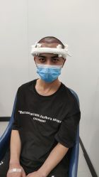 -大麦微针植发全国连锁