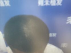 -雍禾植发全国连锁