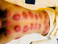 -怡泰SPA·泰疗按摩(徽宁路店)