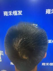 -雍禾植发全国连锁