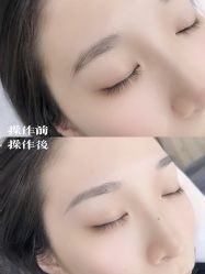 -西施无菌半永久纹绣眉眼影唇轻增发纹发际线