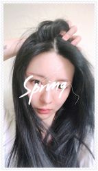 体验后-大麦微针植发全国连锁