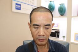 -大麦微针植发丨全国连锁