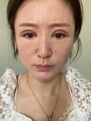 -北京丽星翼美医疗美容