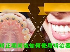 -团圆口腔·种植中心(锦江院区)