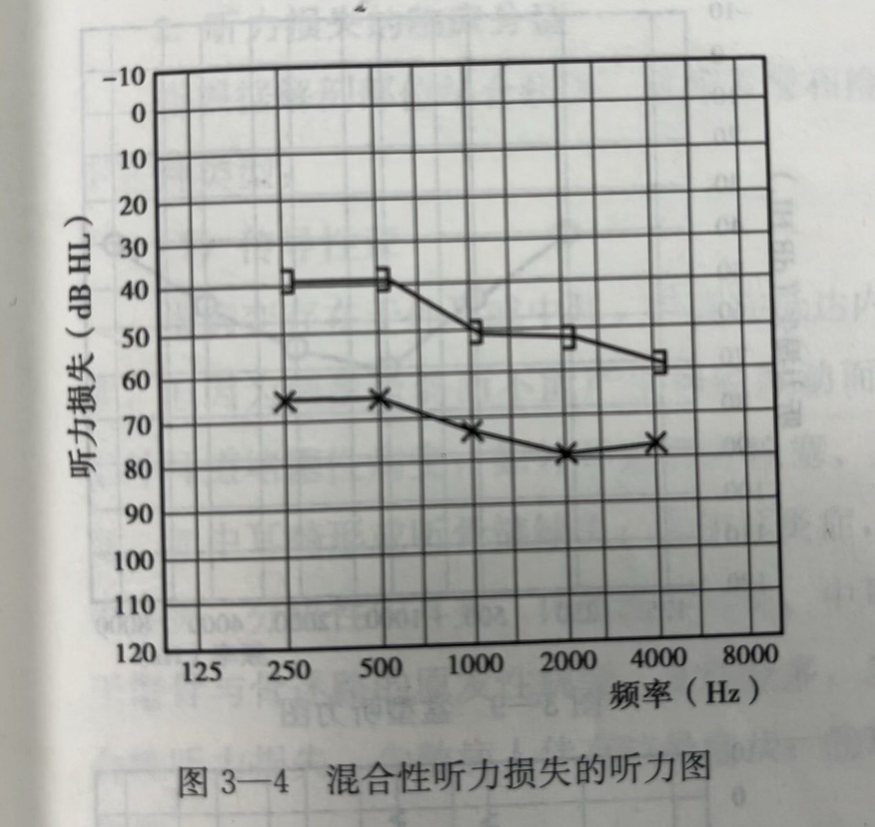 纯音测听报告图怎么看(二)