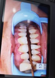体验前-深圳艺星医疗美容医院