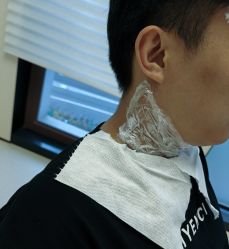 体验前-上海时光整形外科医院