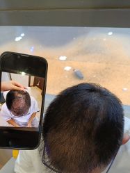 -碧莲盛·不剃发植发