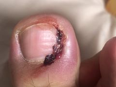 -Andrew指甲专科灰指甲·甲沟炎矫正·3D步态矫形鞋垫定制(上海法华镇路旗舰店)