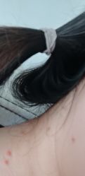 -百年美肤堂祛痦痣祛斑祛疣