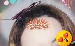 -大麦微针植发全国连锁