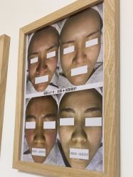 -美肤盾祛痘·问题肌头疗管理中心