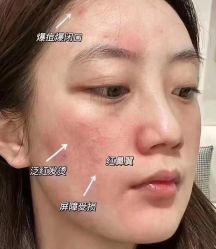 -LUNA皮相美·骨相美高级美感