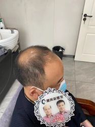 -唐风采假发补发定制