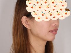 -同步齿科·数字化正畸种植口腔中心(珠海店)