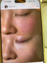 -苑苑vbeauty科技美容SPA
