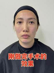 -广州健丽·去眼袋医疗美容机构