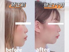 -极光口腔·矫正种植修复(锦江店)