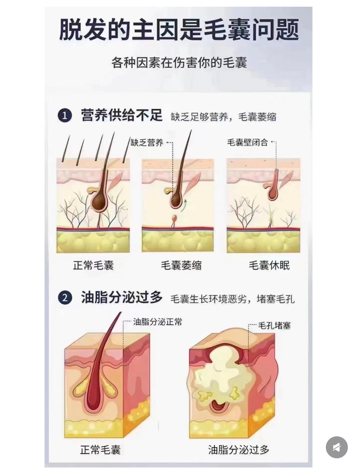 毛发小科普 头发的生长周期\\n头发的生长