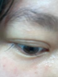 -广州美莱医疗美容医院