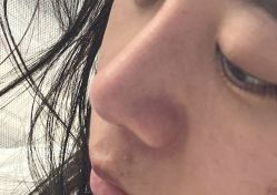 -痘院长·祛痘·科技美肤