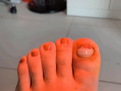 -新甲连锁灰指甲·甲沟炎·鸡眼(黑龙江路店)