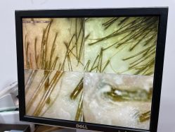 -章光101防脱养发荟