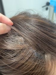 -熙朵美学植发·连锁品牌