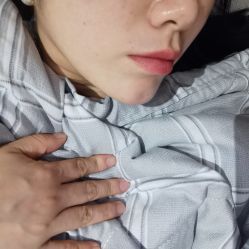 体验后-东剑医学美容·注射美学中心