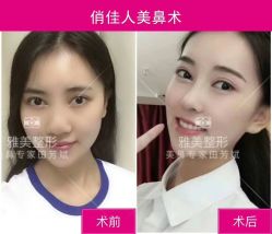 -长沙雅美医疗美容医院