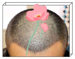 -大麦微针植发全国连锁