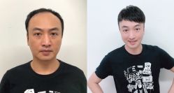 -发饰美男士增发补发假发定制店