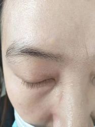 -北京美痣堂古方祛痣斑疣瘊