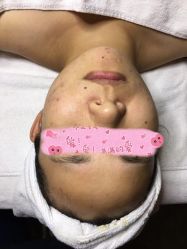 -皇族养心堂·净痘·修敏·御颜
