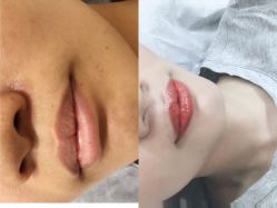 -西施无菌半永久纹绣眉眼影唇轻增发纹发际线