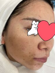 体验前-德媛医疗美容