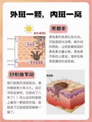 -克丽缇娜